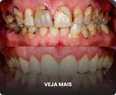 Antes e depois 1