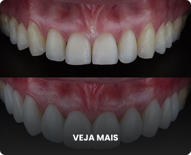 Antes e depois 3