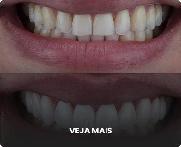 Antes e depois 2